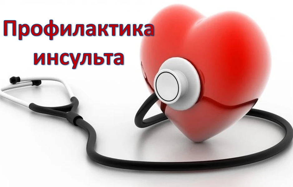 Иркутян приглашают на лекцию «Инсульт: проявления, причины, профилактика»